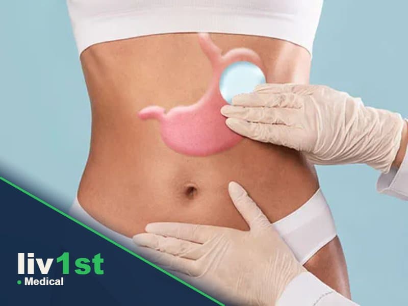 Gastric Botox