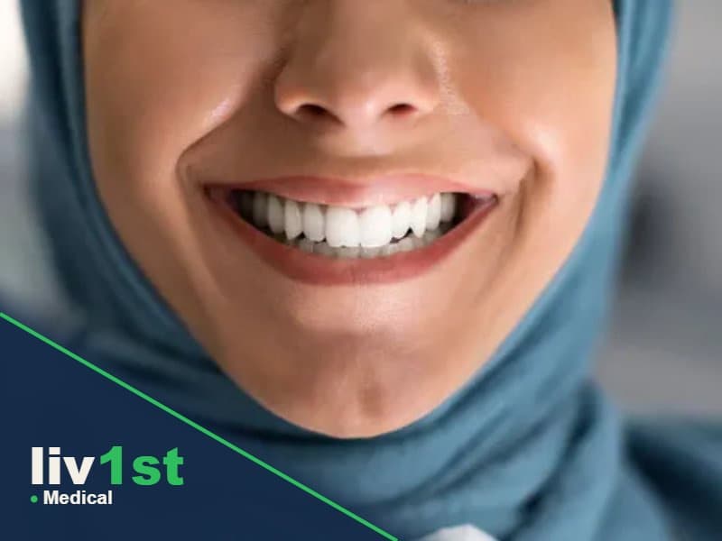Teeth Whitening