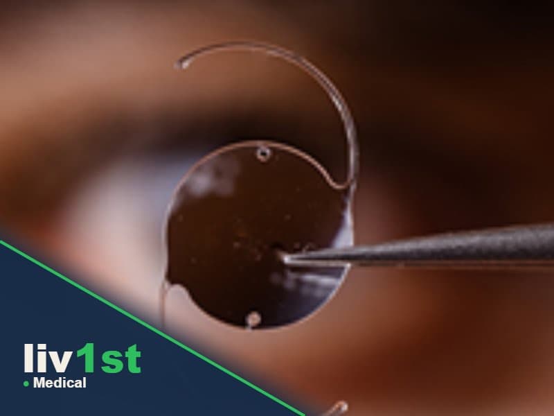 Tri-Focal Smart Lens Surgery