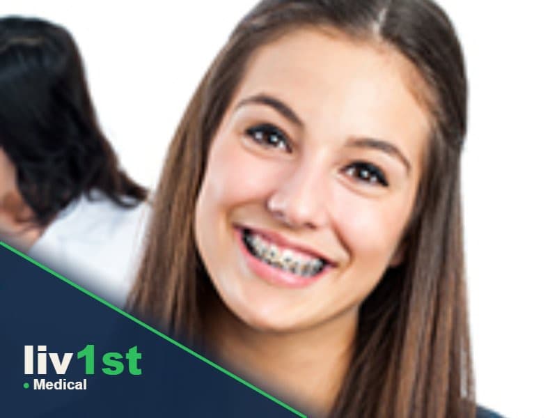 Dental Braces