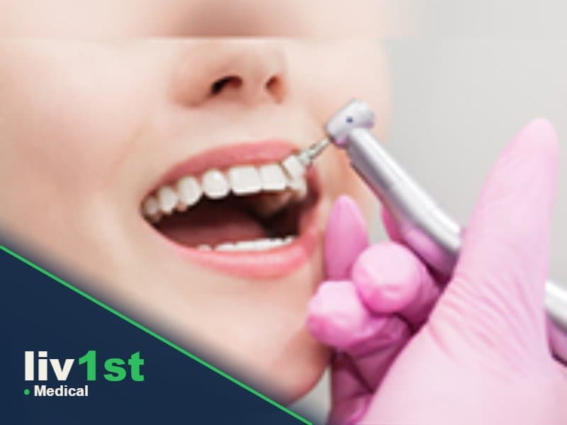 تجميل الأسنان بالكومبوزت (Composite Bonding)