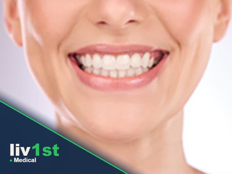 Hollywood Smile