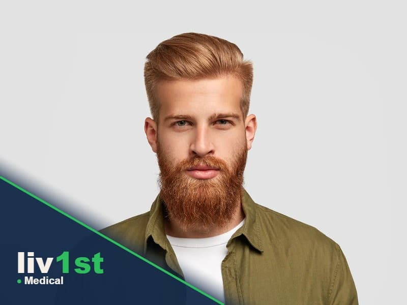Classic FUE Hair Transplant