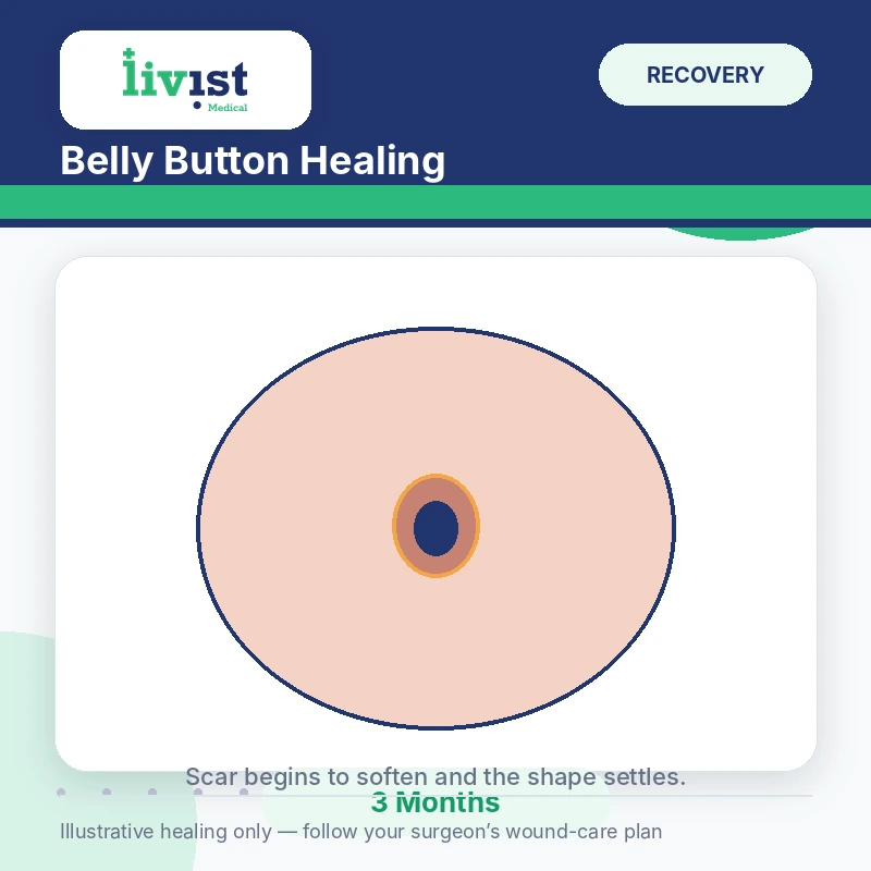 Belly button healing three months after tummy tuck