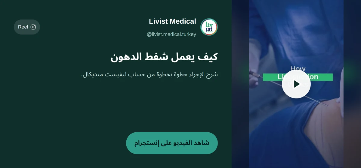 فيديو: كيف تتم عملية شفط دهون البطن خطوة بخطوة مع ليفيست ميديكال