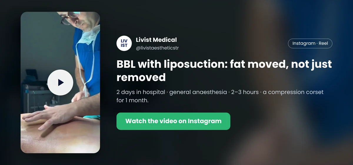 AirSculpt cost alternative for fat transfer: Livist Medical Instagram reel on BBL with liposuction