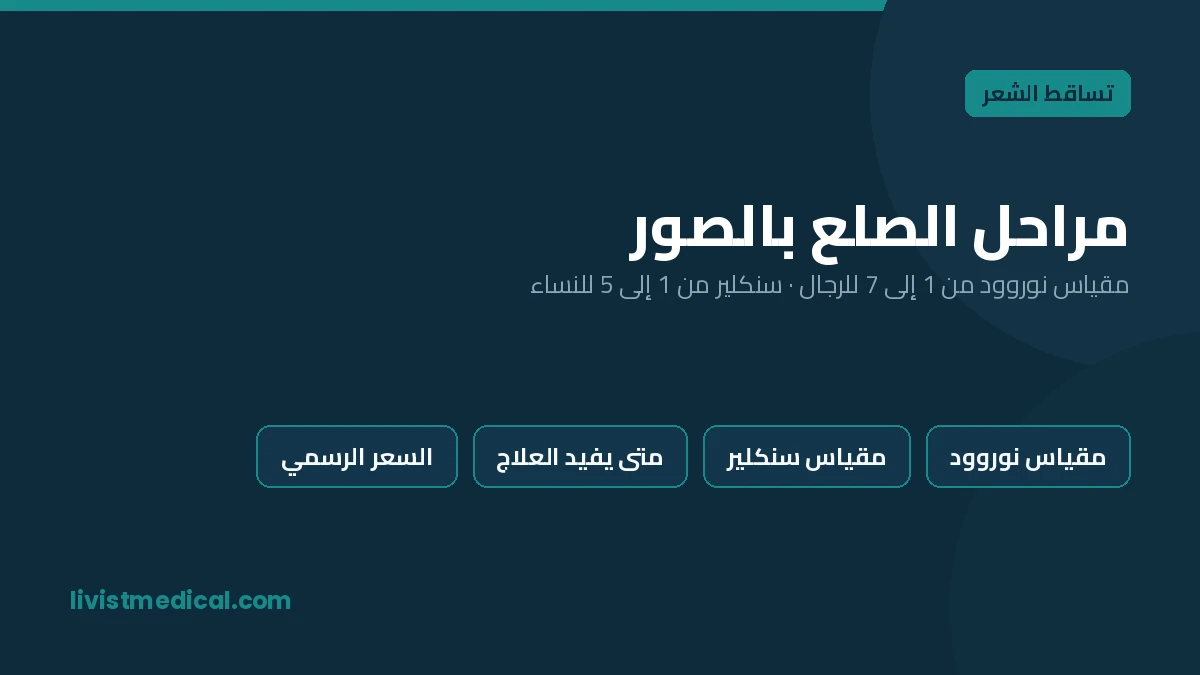 مراحل الصلع بالصور: مقياس نوروود من الدرجة 1 إلى 7