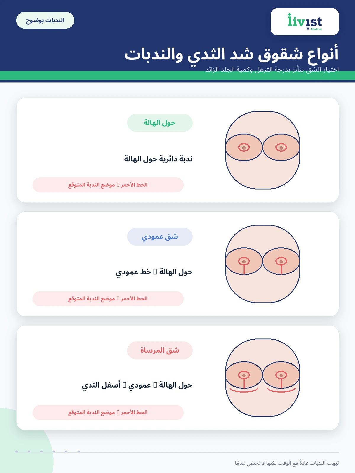 أنواع شقوق عملية شد الثدي والندبات الناتجة