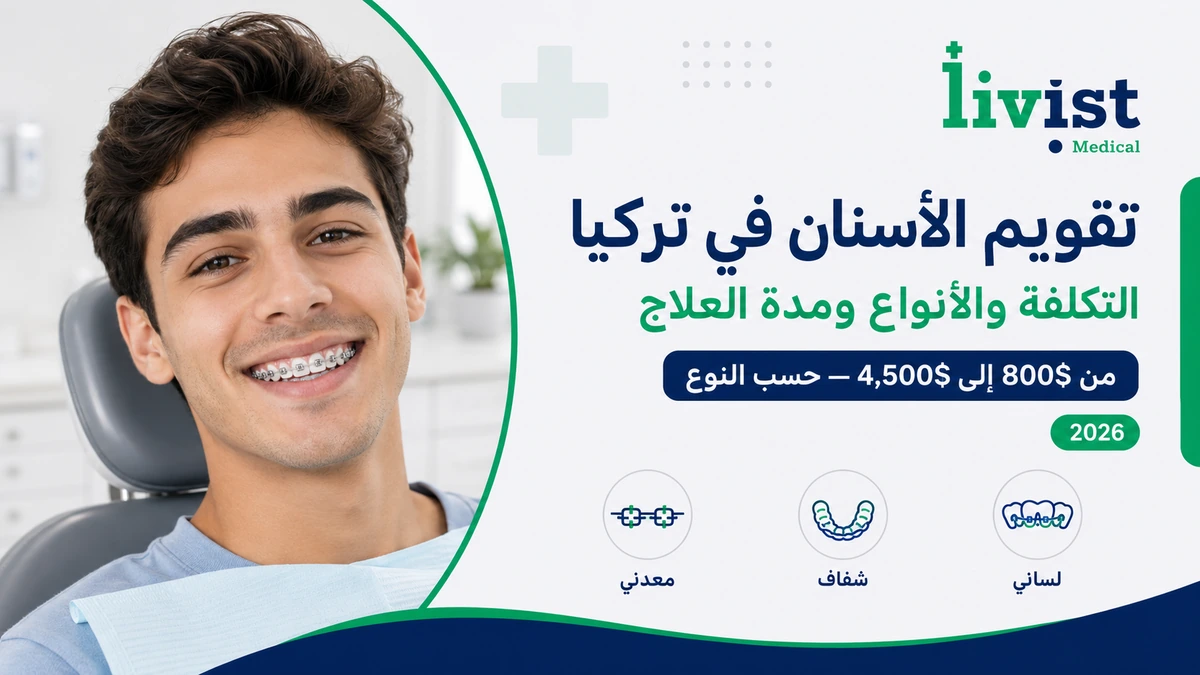 تكلفة تقويم الأسنان في تركيا 2026: الأسعار والمدة