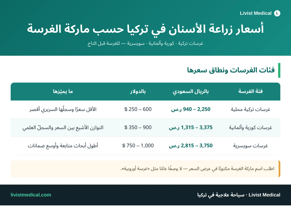 إنفوجرافيك أسعار زراعة الأسنان في تركيا حسب ماركة الغرسة: تركية وكورية وألمانية وسويسرية