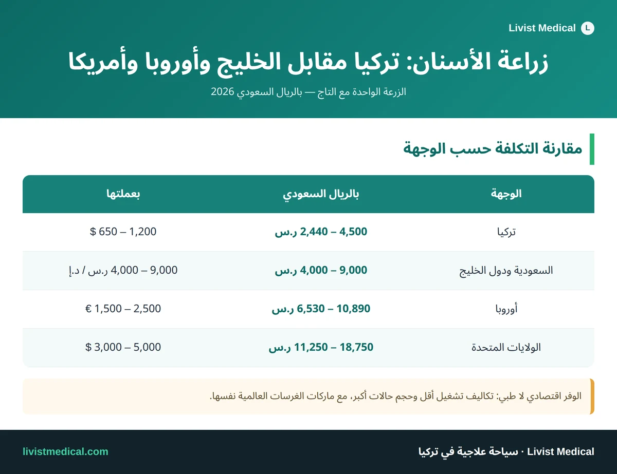 إنفوجرافيك مقارنة تكلفة زراعة الأسنان بين تركيا والخليج وأوروبا والولايات المتحدة بالريال السعودي