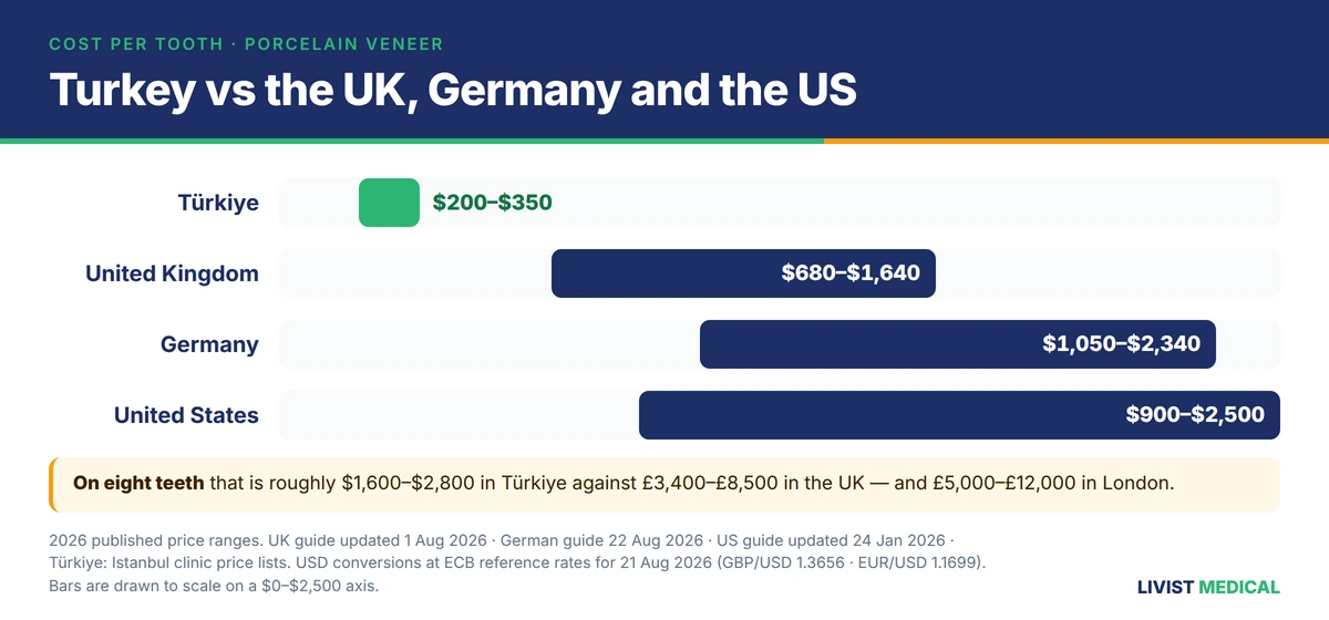 Veneer cost per tooth across four countries