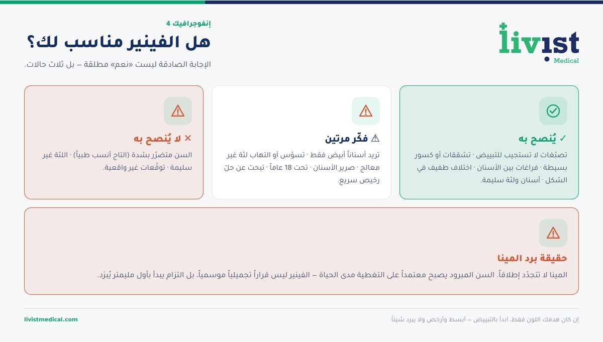 شجرة قرار لتحديد ما إذا كان فينير الأسنان مناسباً لحالتك