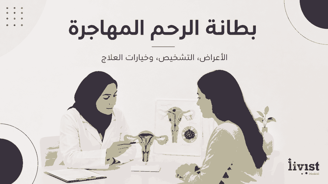 بطانة الرحم المهاجرة: الأعراض والتشخيص والعلاج والتكلفة | دليل 2026