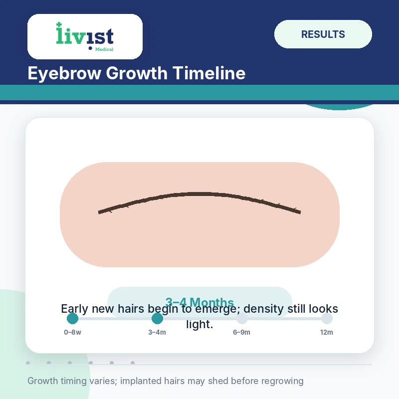 Eyebrow transplant growth at three months
