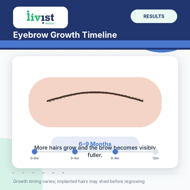 Eyebrow transplant growth at six months