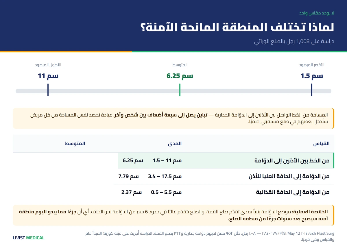 التباين في حدود المنطقة المانحة الآمنة بين الرؤوس