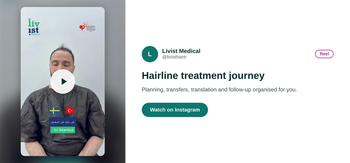 Livist Hair Instagram reel card about a hair transplant case and the services included