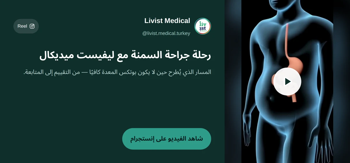 فيديو: رحلة مريض جراحة سمنة مع ليفيست ميديكال — بديل بوتكس المعدة لمن مؤشر كتلته أعلى من 40