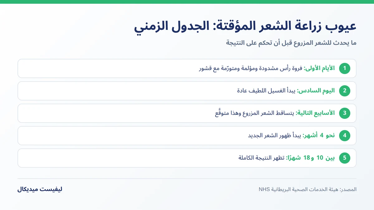 تساقط الشعر المزروع ضمن عيوب زراعة الشعر المؤقتة