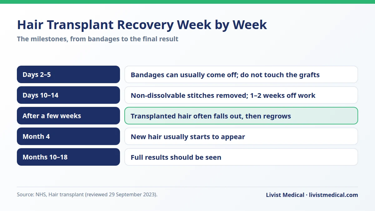 Hair transplant recovery week by week: NHS milestones from bandages to final results