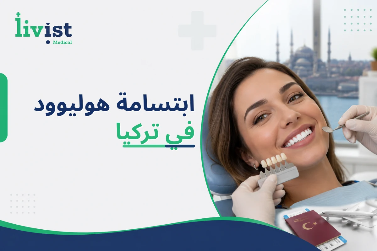 ابتسامة هوليوود في تركيا 2026: التكلفة، المراحل، النتائج، والعيادات الموصى بها