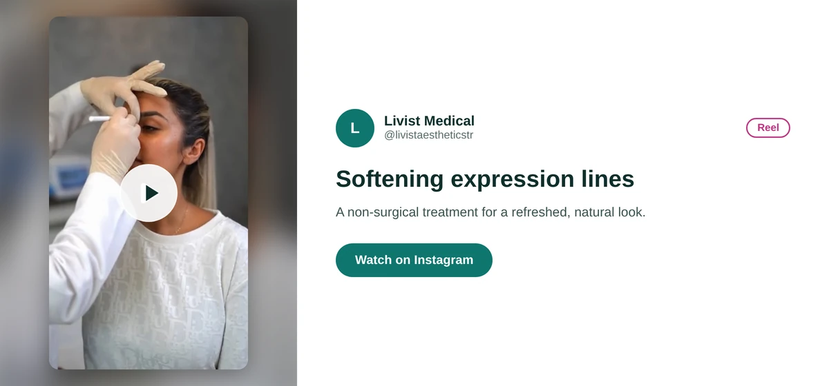 Livist Aesthetics Instagram reel card about Botox treatment for expression lines