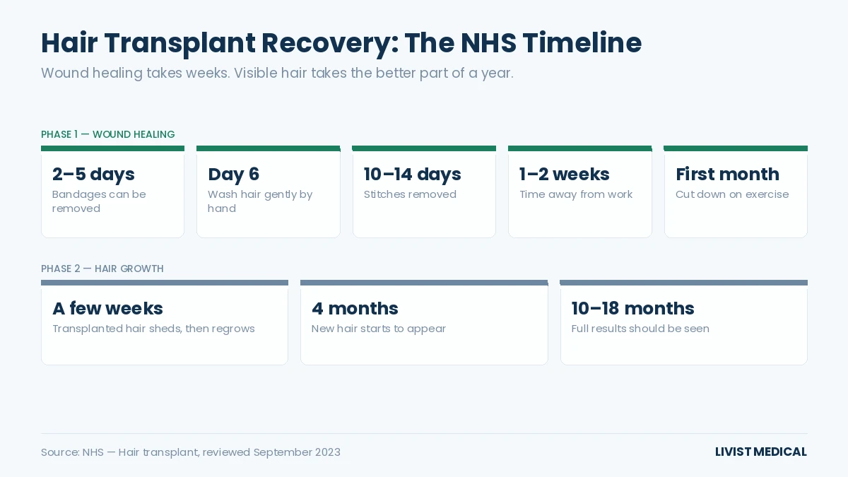 Hair transplant recovery timeline from bandages off to full results