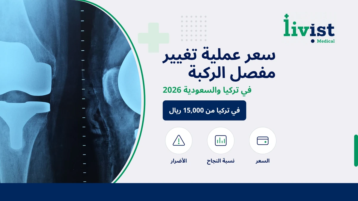 سعر عملية تغيير مفصل الركبة 2026 في تركيا والسعودية