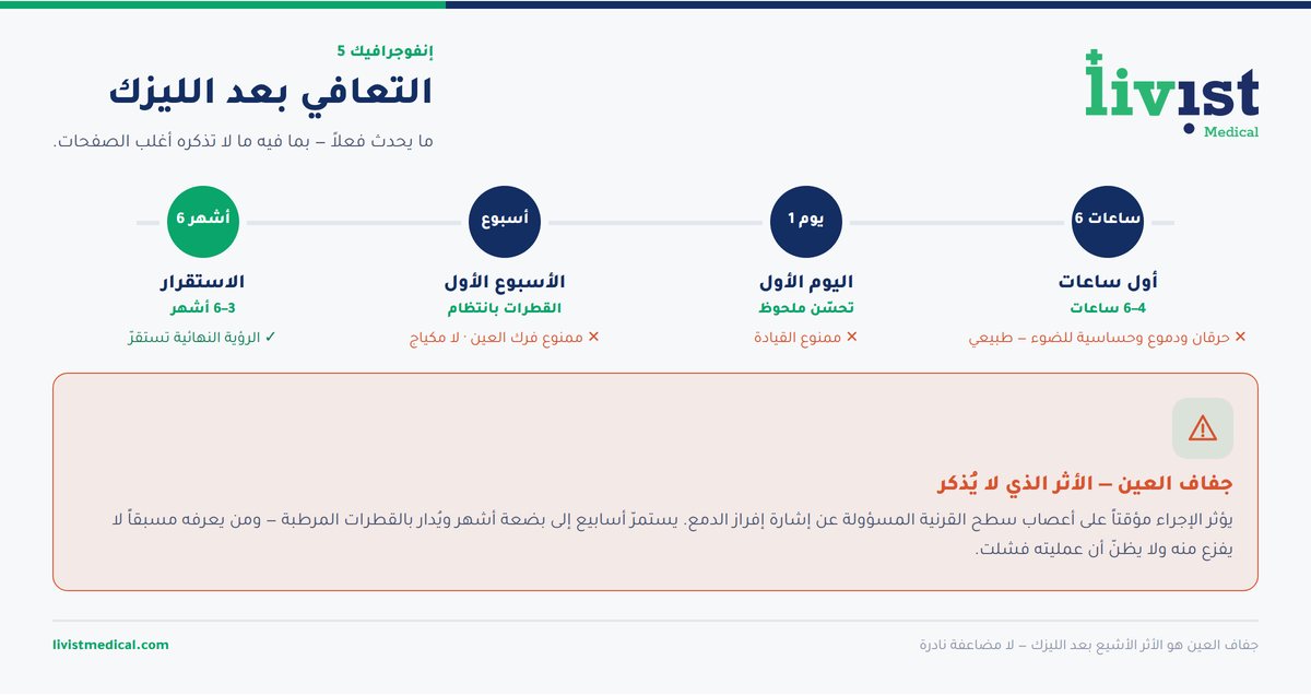 جدول التعافي بعد عملية الليزك من اليوم الأول حتى استقرار النظر