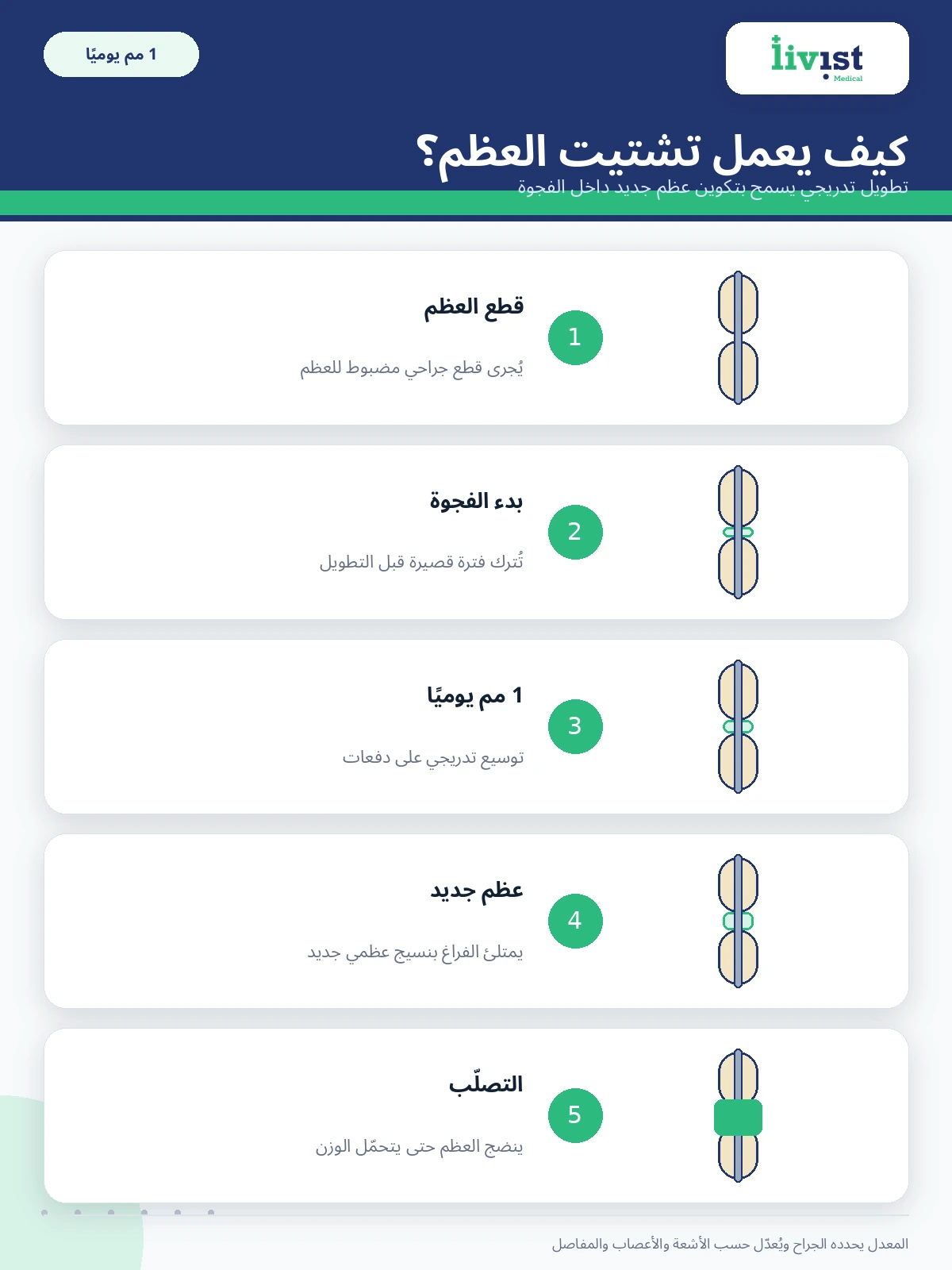 كيف تعمل تقنية تشتيت العظم لزيادة الطول 1 مم يوميًا