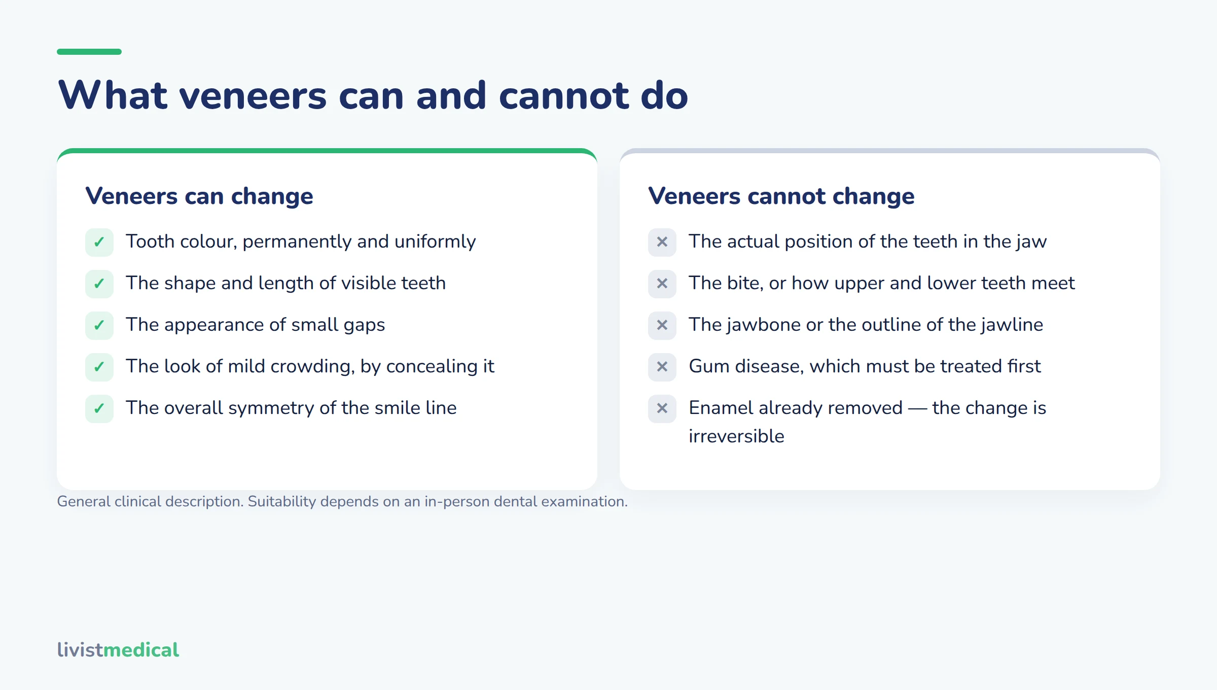 What dental veneers can and cannot change