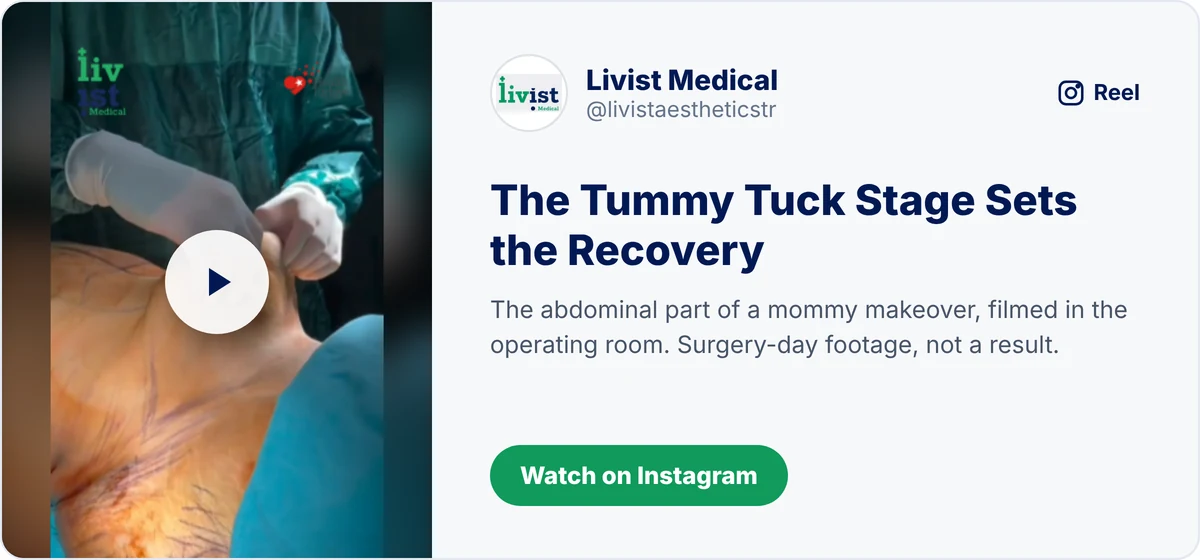 Mommy makeover recovery video: the tummy tuck stage that sets the recovery timeline