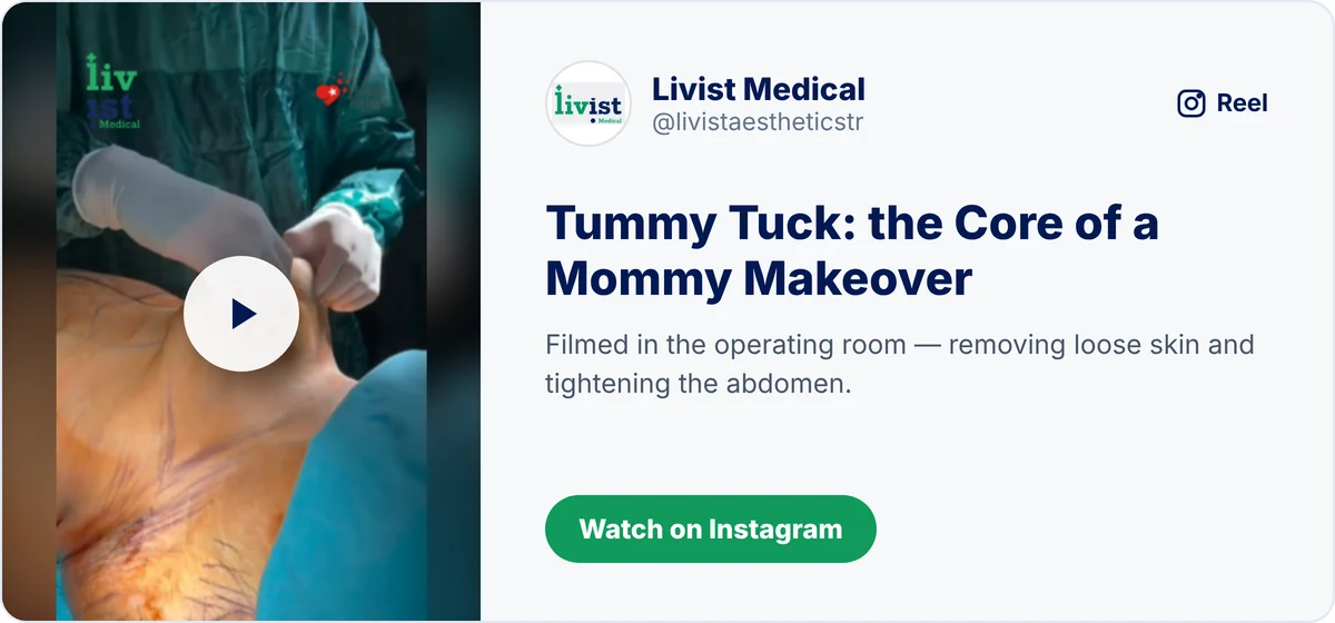Mommy makeover Turkey video: tummy tuck stage filmed in the operating room