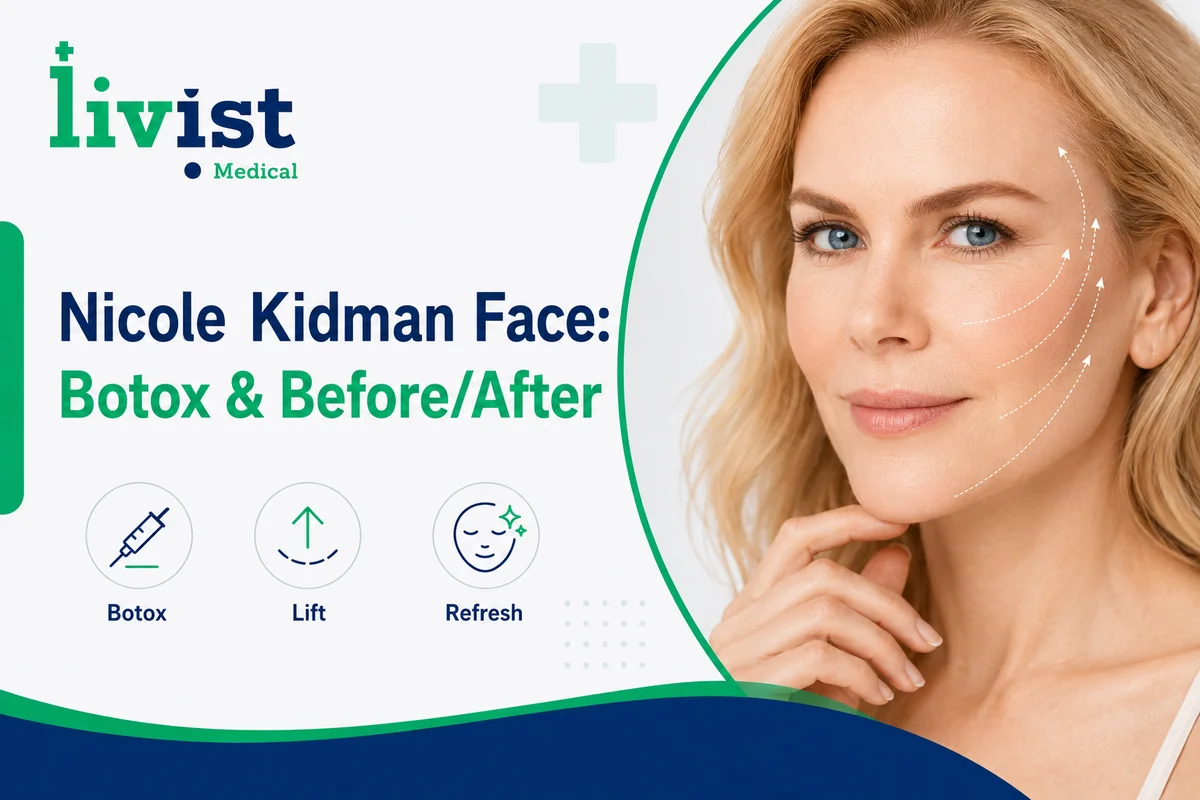 Nicole Kidman Face: Botox, Before & After, and What Surgeons Say (2026)