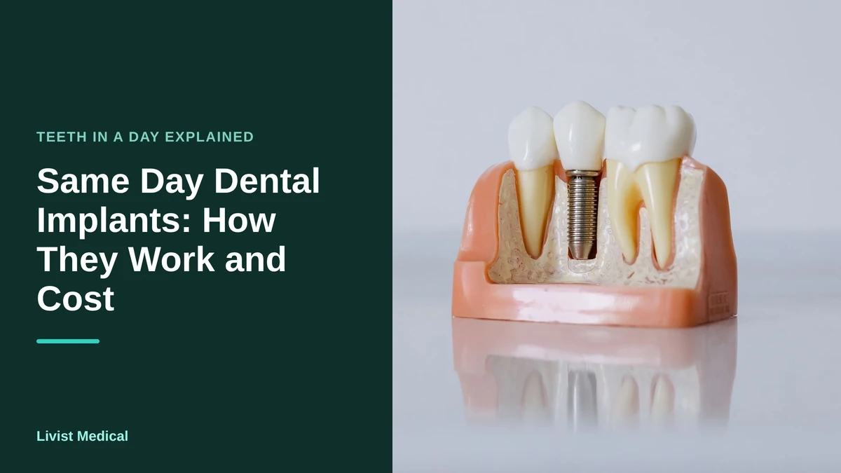 Same Day Dental Implants: How They Work and Cost (2026)
