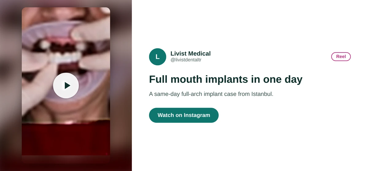 Livist Dental Instagram reel card showing full mouth implants done in one day