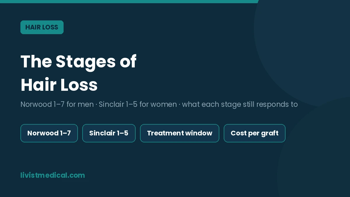Stages of Hair Loss: Norwood and Sinclair Scales Explained
