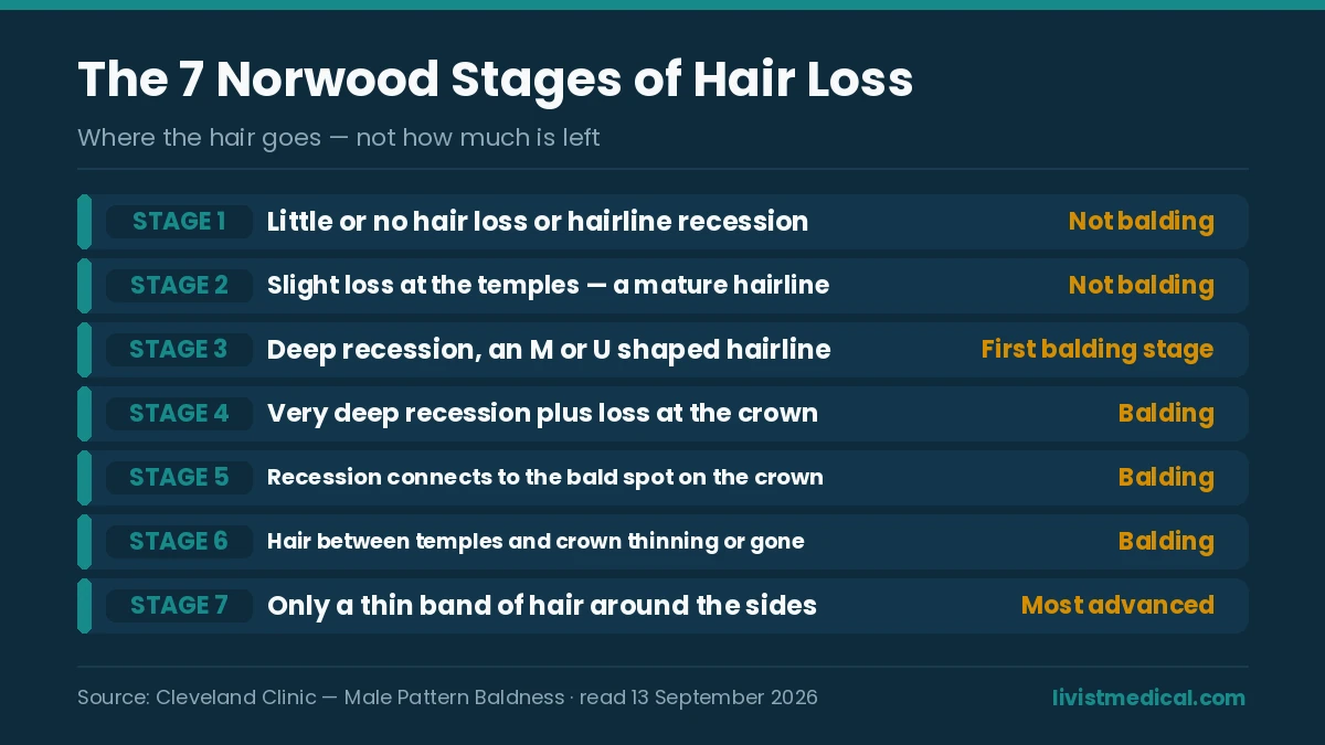 The seven Norwood stages of hair loss from stage 1 to stage 7