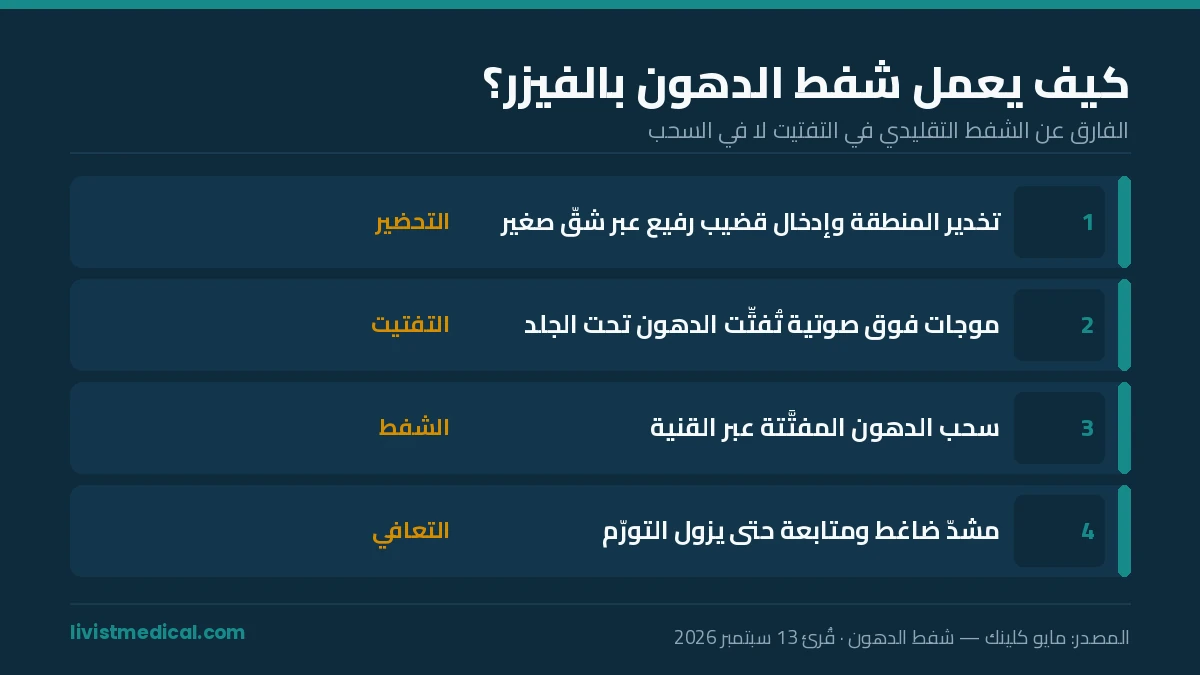 كيف تعمل عملية شفط الدهون بالفيزر بالموجات فوق الصوتية
