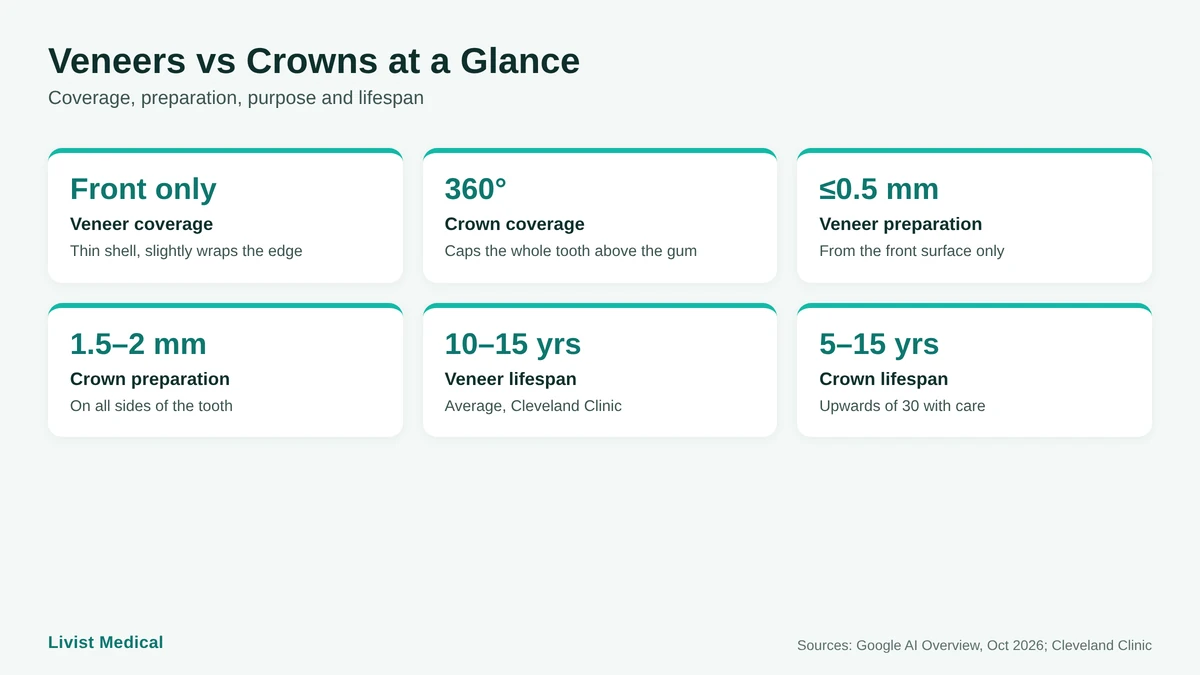 Veneers vs crowns comparison infographic showing coverage, tooth preparation, purpose and lifespan