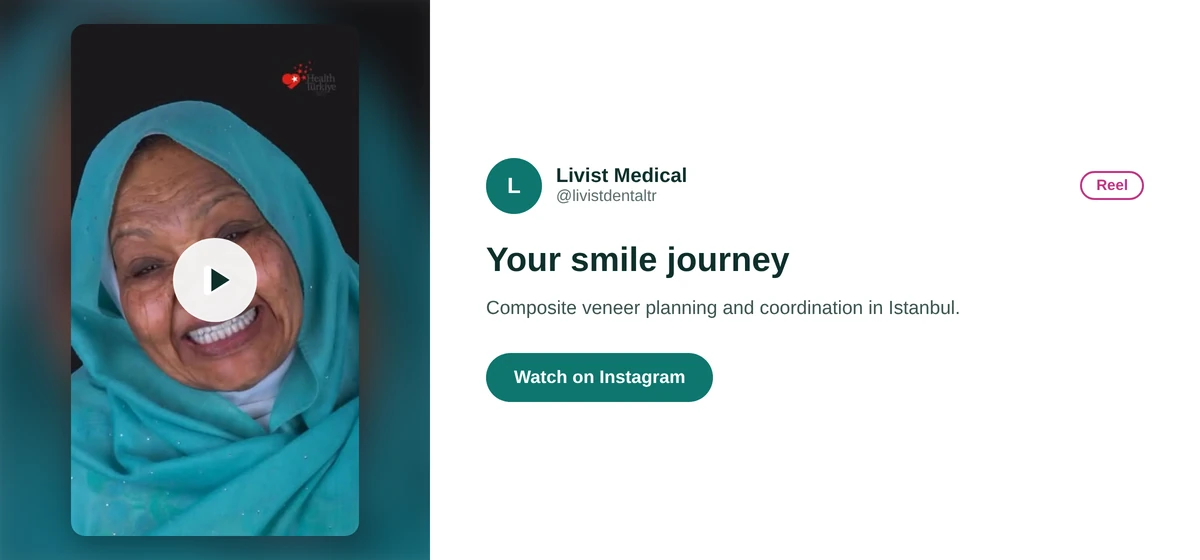 Livist Dental Instagram reel card about a composite veneer smile journey in Istanbul