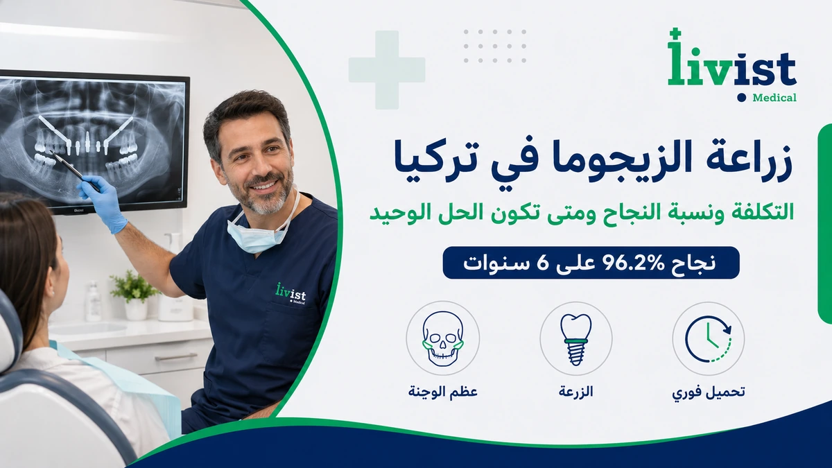 زراعة الزيجوما 2026: التكلفة ونسبة النجاح والمخاطر