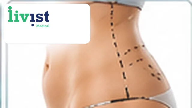 360° Liposuction