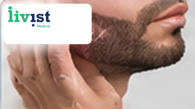 Beard and Chin Hair Transplant