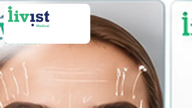 Eyebrow Lift
