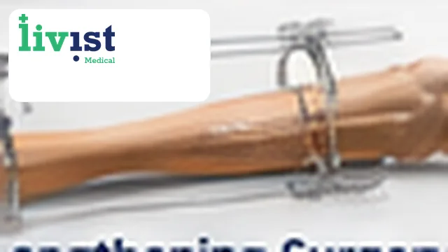 Height Lengthening Surgery – Precice Technique
