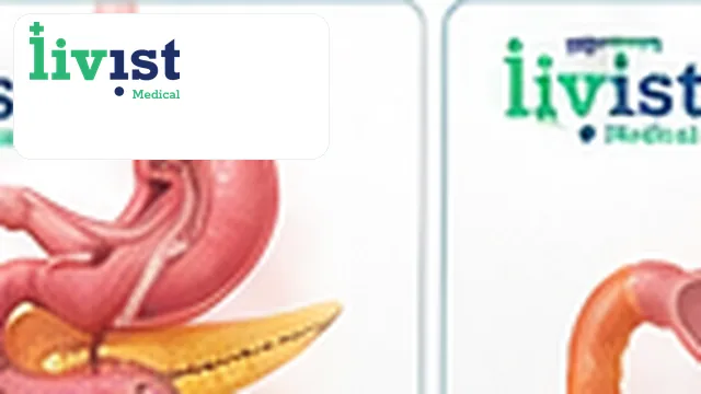 Mini Gastric Bypass (Laparoscopic)