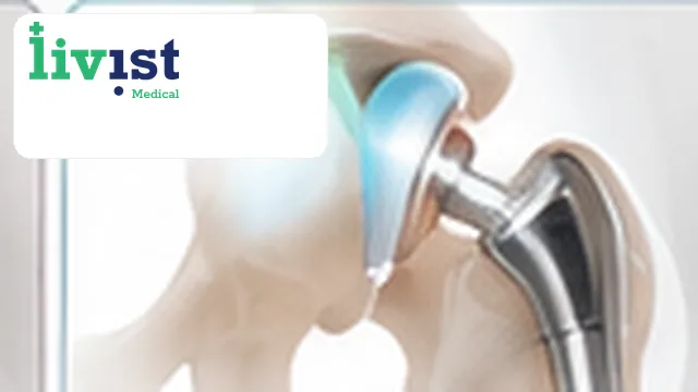 Shoulder Joint Replacement