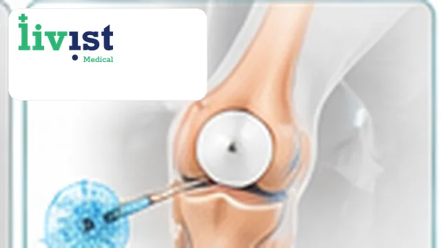 Stem Cell Injection for Knees